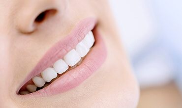 Closeup of beautiful smile with porcelain veneers