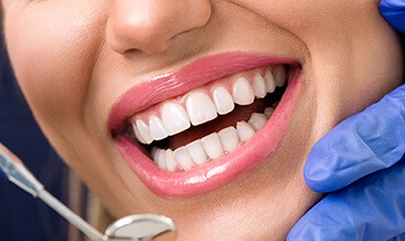 Closeup of healthy smile examined by dentist