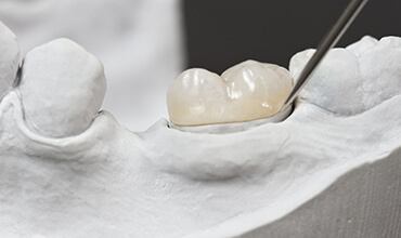 Ceramic model of tooth with dental crown