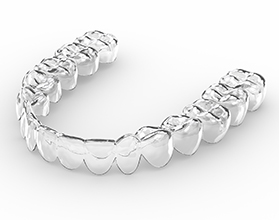 A digital image of an Invisalign aligner in Chevy Chase