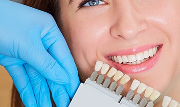 Woman's smile compared with tooth color chart