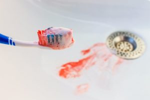 toothbrush bleeding gums