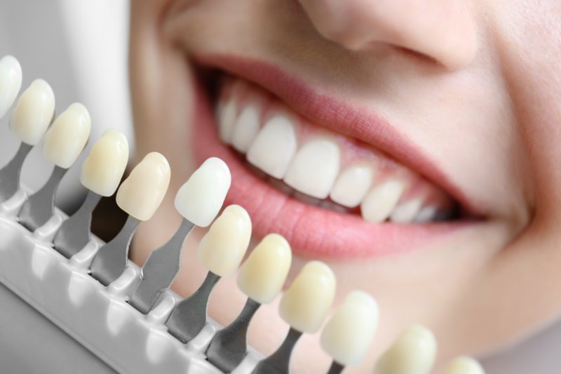 Woman smiling with veneers shade samples in front of her face