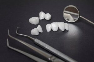 Lumineers flanked by dental tools.